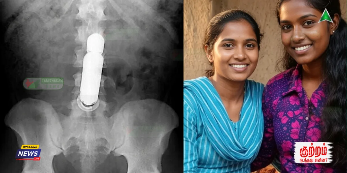 "எல்லைமீறிய லெஸ்பியன் மோகம்!" வயிற்றுக்குள் சிக்கிய அந்தரங்க சாதனம்!எக்ஸ்ரே பார்த்து அலறிய மருத்துவர்